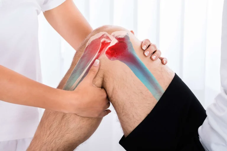 Is Cryotherapy Right for You a Beginners Guide?