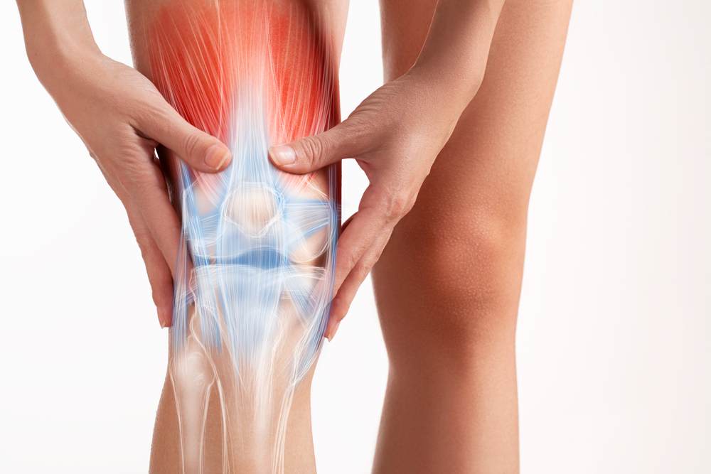 ACL tear