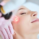 Pico Laser Side Effects: Essential Information You Need to Know